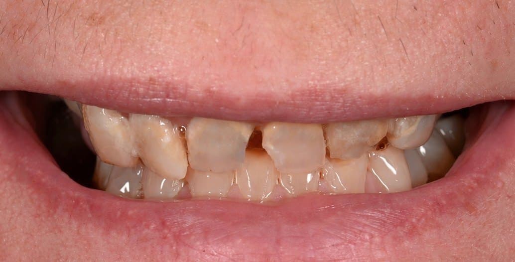 Before treatment, case 1