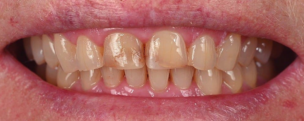 Before treatment, case 2