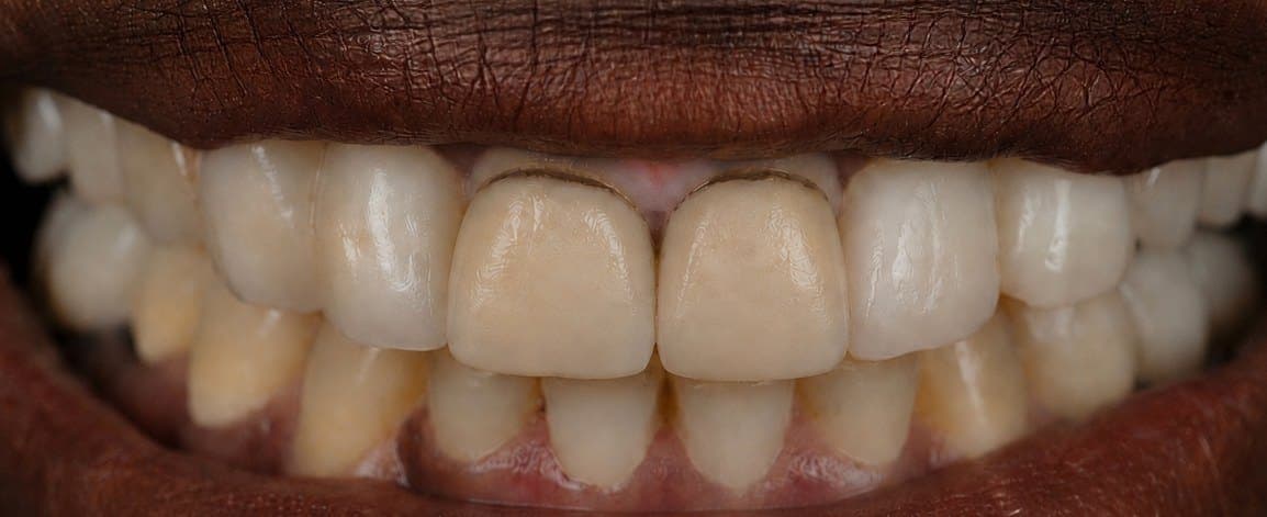 Before treatment, case 3